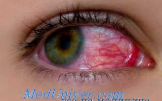 Термический ожог глаза: первая помощь и лечение