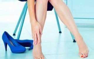 Причины того, почему появляются часто синяки на ногах